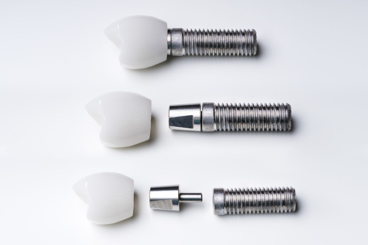 dental implant parts