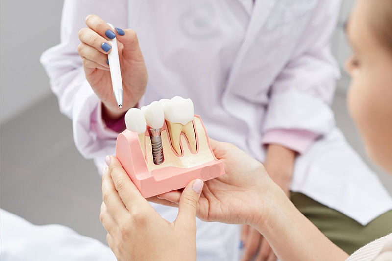 dental implant parts